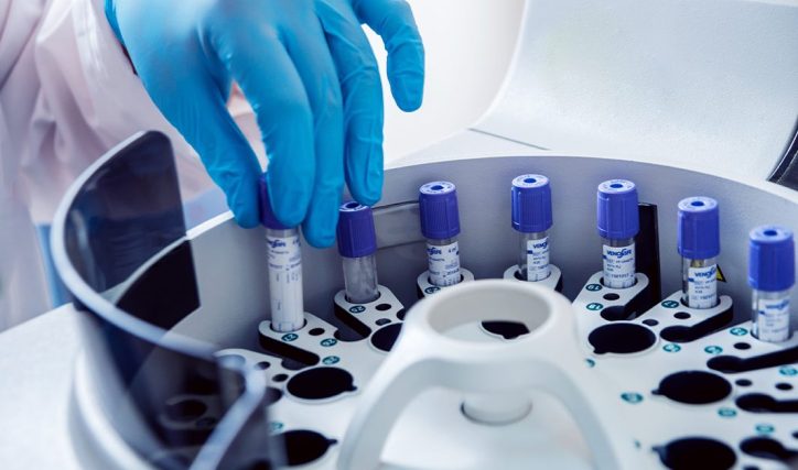Close-up of a laboratory centrifuge holding multiple capped blood sample tubes, while a gloved hand places a sample into the rotor tray for processing.